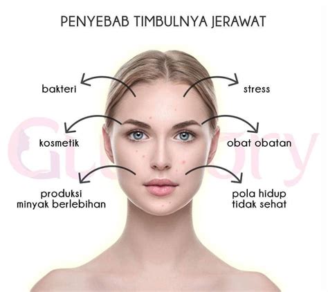 5 Cara Merawat Kulit Wajah Remaja Glowing Alami! 5 Cara Merawat Kulit Wajah Remaja Glowing Alami!