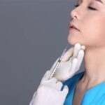 5 Fakta Mengenai Harga Botox Wajah di MS Glow yang Hanya Rp 8 Jutaan!