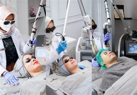5 Harga Facial Bening's Clinic: Rahasia Glowing Mulai dari RpXXX! 5 Harga Facial Bening's Clinic: Rahasia Glowing Mulai dari RpXXX!
