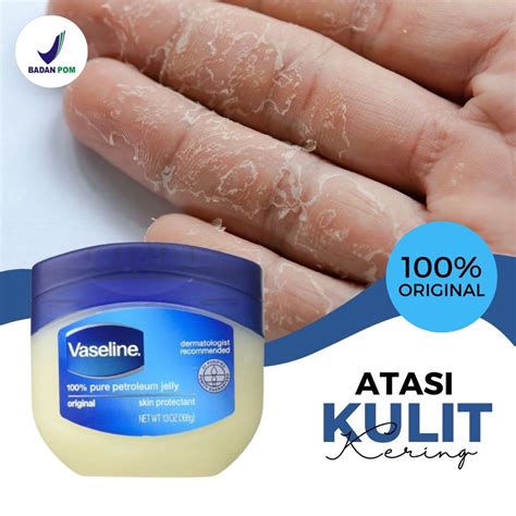5 Keajaiban Petroleum Jelly untuk Kulit Kering yang Wajib Kamu Tahu! 5 Keajaiban Petroleum Jelly untuk Kulit Kering yang Wajib Kamu Tahu!