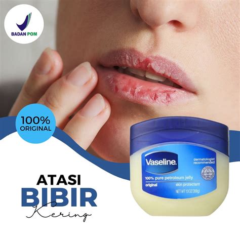 5 Keajaiban Petroleum Jelly untuk Kulit Kering yang Wajib Kamu Tahu! 5 Keajaiban Petroleum Jelly untuk Kulit Kering yang Wajib Kamu Tahu!