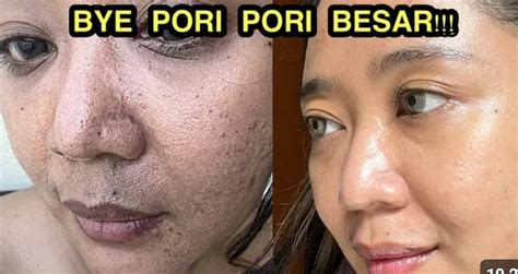 5 Masker Ajaib Hempas Pori-Pori Besar: Kulit Mulus dalam Semalam!
