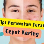 -

5 Trik Mudah untuk Kulit Bebas Jerawat dalam 2 Minggu!