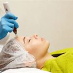 7 Biaya Treatment Dermapen yang Wajib Kamu Tahu Sebelum Melakukannya, Mulai dari Rp 1 Jutaan!