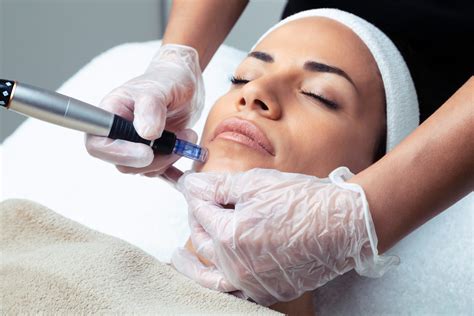 7 Biaya Treatment Dermapen yang Wajib Kamu Tahu Sebelum Melakukannya, Mulai dari Rp 1 Jutaan! 7 Biaya Treatment Dermapen yang Wajib Kamu Tahu Sebelum Melakukannya, Mulai dari Rp 1 Jutaan!