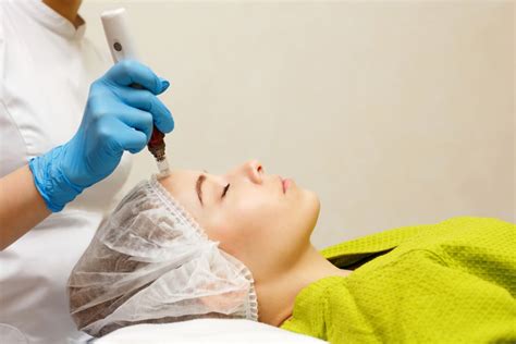 7 Biaya Treatment Dermapen yang Wajib Kamu Tahu Sebelum Melakukannya, Mulai dari Rp 1 Jutaan!