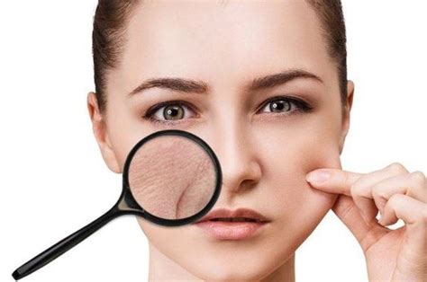 7 Cara Efektif untuk Mengatasi Perawatan Muka Kering yang Wajib Kamu Coba Sekarang 7 Cara Efektif untuk Mengatasi Perawatan Muka Kering yang Wajib Kamu Coba Sekarang