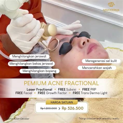 7 Harga Immoderma Paling Kompetitif untuk Membantu Anda Mencapai Wajah yang Mulus dalam 30 Hari!