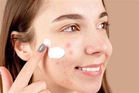 7 Kosmetik Ampuh Hempas Kilap and Jerawat: Rahasia Kulit Mulus Bebas Drama! 7 Kosmetik Ampuh Hempas Kilap and Jerawat: Rahasia Kulit Mulus Bebas Drama!