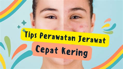 7 Langkah Ampuh Basmi Wajah Kusam dan Jerawat!