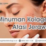 7 Manfaat Kolagen Ajaib untuk Mengatasi Jerawat Membandel!