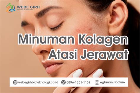 7 Manfaat Kolagen Ajaib untuk Mengatasi Jerawat Membandel!