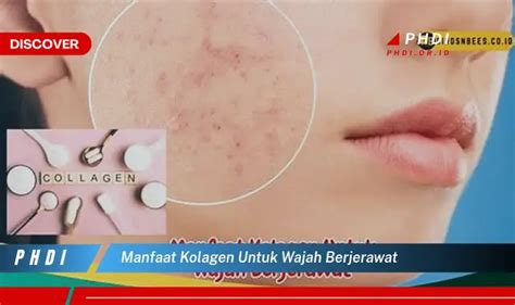 7 Manfaat Kolagen yang Tak Terduga untuk Kulit Berjerawat! 7 Manfaat Kolagen yang Tak Terduga untuk Kulit Berjerawat!
