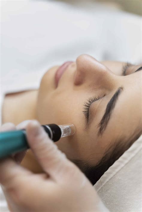 7 Rahasia Kulit Glowing Setelah Dermapen: Wajib Coba5! 7 Rahasia Kulit Glowing Setelah Dermapen: Wajib Coba5!