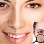 7 Rahasia Kulit Lembap Anti Kering: Katakan Bye-Bye pada Kulit Bersisik!