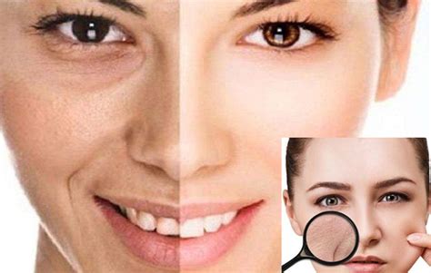 7 Rahasia Kulit Lembap Anti Kering: Katakan Bye-Bye pada Kulit Bersisik!