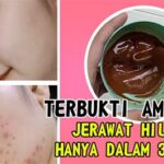 7 Rahasia Wajah Bebas Jerawat Alami: Terbukti Ampuh!