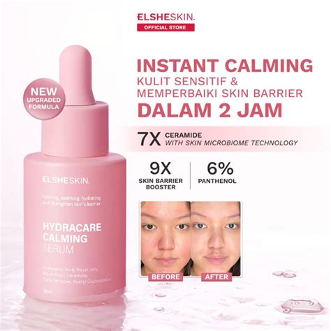7 Serum Wajah Terbaik untuk Kulit Kombinasi yang Bikin Wajahmu Glowing dalam 1 Minggu! 7 Serum Wajah Terbaik untuk Kulit Kombinasi yang Bikin Wajahmu Glowing dalam 1 Minggu!