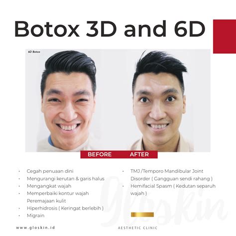 7 Treatment Gloskin di Bawah 500 Ribu: Rahasia Glowing Tanpa Bikin Kantong Bolong! 7 Treatment Gloskin di Bawah 500 Ribu: Rahasia Glowing Tanpa Bikin Kantong Bolong!
