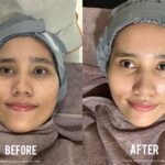 7 Treatment Wajah di ERHA di Bawah 500 Ribu! Budget Pas-pasan, Wajah Tetap Glowing!