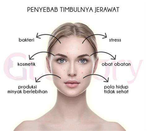 5 Cara Jitu Merawat Wajah Berjerawat and Sensitif: Bye-bye Iritasi! 5 Cara Jitu Merawat Wajah Berjerawat and Sensitif: Bye-bye Iritasi!
