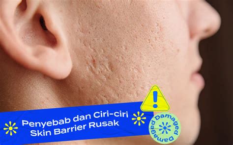 5 Kesalahan Perawatan Skincare yang Bikin Kulitmu Gagal Glowing! 5 Kesalahan Perawatan Skincare yang Bikin Kulitmu Gagal Glowing!
