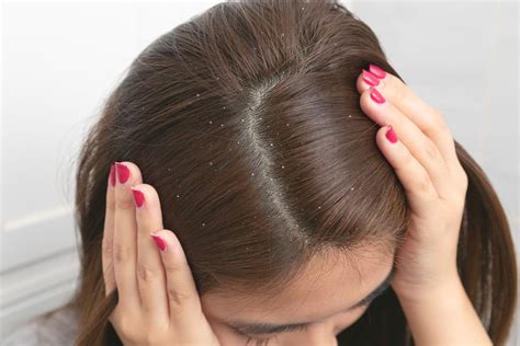 5 Treatment Kulit Kepala TERBAIK untuk Rambut Lebih Sehat and Tebal! 5 Treatment Kulit Kepala TERBAIK untuk Rambut Lebih Sehat and Tebal!