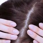 5 Treatment Kulit Kepala TERBAIK untuk Rambut Lebih Sehat and Tebal!