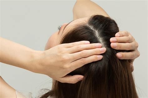 5 Treatment Kulit Kepala TERBAIK untuk Rambut Lebih Sehat and Tebal! 5 Treatment Kulit Kepala TERBAIK untuk Rambut Lebih Sehat and Tebal!