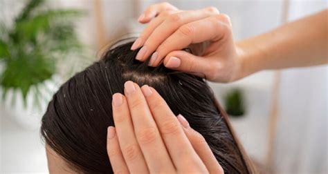 5 Treatment Kulit Kepala TERBAIK untuk Rambut Lebih Sehat and Tebal! 5 Treatment Kulit Kepala TERBAIK untuk Rambut Lebih Sehat and Tebal!