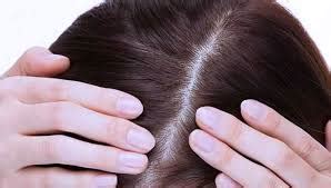 5 Treatment Kulit Kepala TERBAIK untuk Rambut Lebih Sehat and Tebal!