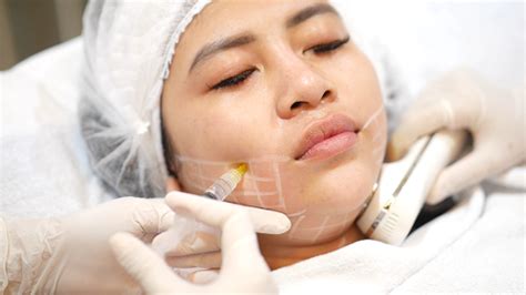 5 Treatment Penirus Wajah Terampuh: Bye-Bye Pipi Chubby! 5 Treatment Penirus Wajah Terampuh: Bye-Bye Pipi Chubby!