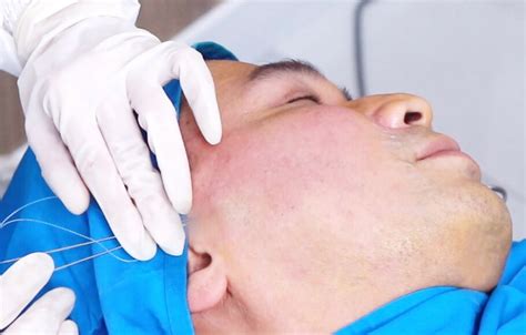 5 Treatment Penirus Wajah Terampuh: Bye-Bye Pipi Chubby! 5 Treatment Penirus Wajah Terampuh: Bye-Bye Pipi Chubby!