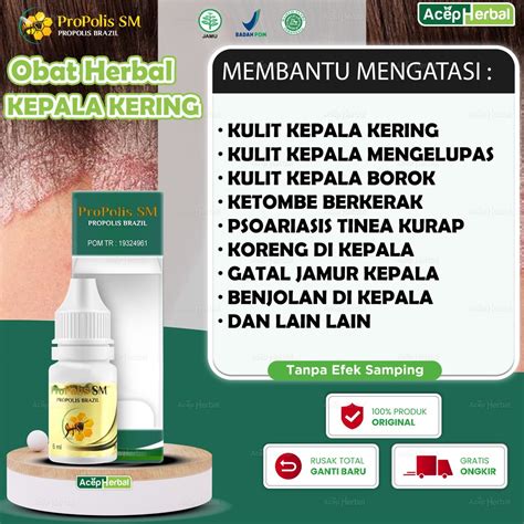 7 Cara Alami untuk Mengatasi Kulit Kepala Kering dan Mengelupas yang Wajib Kamu Coba! 7 Cara Alami untuk Mengatasi Kulit Kepala Kering dan Mengelupas yang Wajib Kamu Coba!