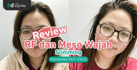 7 Cara Ampuh Mengecilkan Pipi Tembem dengan Meso Wajah 7 Cara Ampuh Mengecilkan Pipi Tembem dengan Meso Wajah