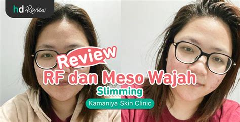 7 Cara Ampuh Mengecilkan Pipi Tembem dengan Meso Wajah 7 Cara Ampuh Mengecilkan Pipi Tembem dengan Meso Wajah