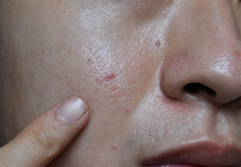 7 Cara Ampuh Merawat Wajah dengan Baik: Glowing Maksimal Dalam Seminggu! 7 Cara Ampuh Merawat Wajah dengan Baik: Glowing Maksimal Dalam Seminggu!