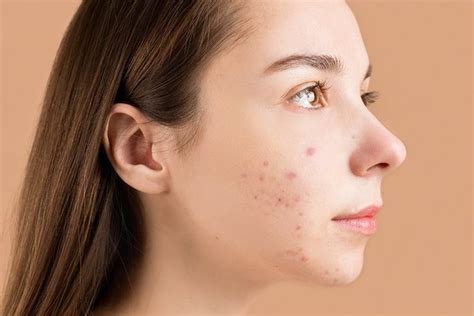 7 Cara Memelihara Kulit Glowing, Bye-Bye Kusam! 7 Cara Memelihara Kulit Glowing, Bye-Bye Kusam!