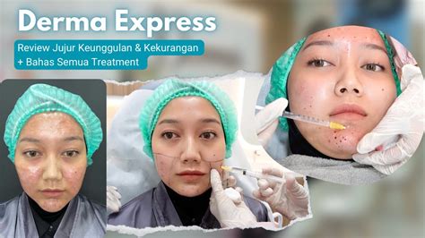 7 Fakta Mengejutkan Harga Facial di Derma Express! Nomor 5 Bikin Dompet Senyum!