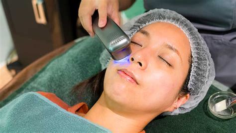 7 Fakta Mengejutkan Soal Biaya Laser Wajah Pria: Nomor 5 Bikin Dompet Nangis!