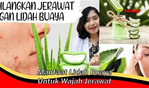 7 Jurus Ampuh Basmi Jerawat Secara Alami! 7 Jurus Ampuh Basmi Jerawat Secara Alami!