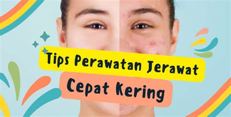 7 Kebiasaan Ampuh Hempas Jerawat: Bye-Bye Kulit Meradang! 7 Kebiasaan Ampuh Hempas Jerawat: Bye-Bye Kulit Meradang!