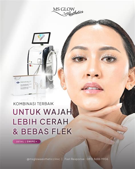 7 Treatment Bening's Clinic yang Bikin Wajah Glowing Instan, Nomor 5 Bikin Kaget!