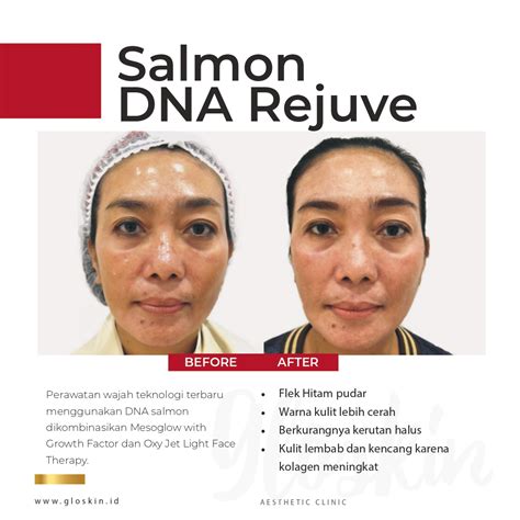 7 Treatment Gloskin di Bawah 1 Juta yang Bikin Glowing Instan! 7 Treatment Gloskin di Bawah 1 Juta yang Bikin Glowing Instan!