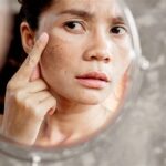5 Skincare Alami Ampuh Lindungi Kulit Setelah Laser