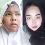 7 Rahasia Perawatan Wajah Remaja Glowing Bebas Jerawat!
