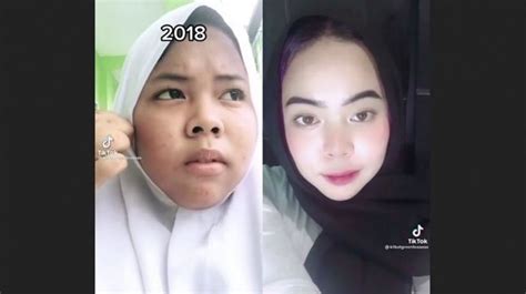 7 Rahasia Perawatan Wajah Remaja Glowing Bebas Jerawat!